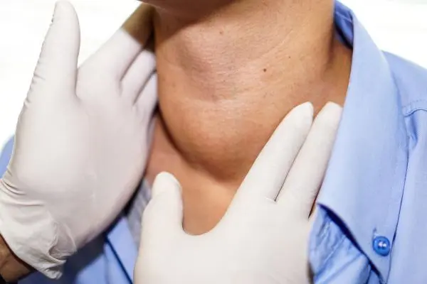 tratamento da tireiode em campinas