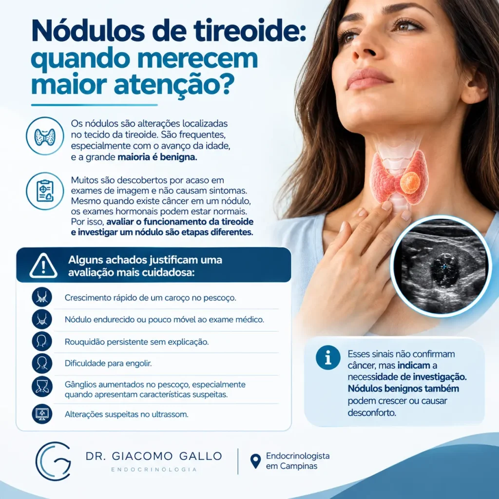 Nódulos de tireoide: quando merecem maior atenção e avaliação com endocrinologista em Campinas